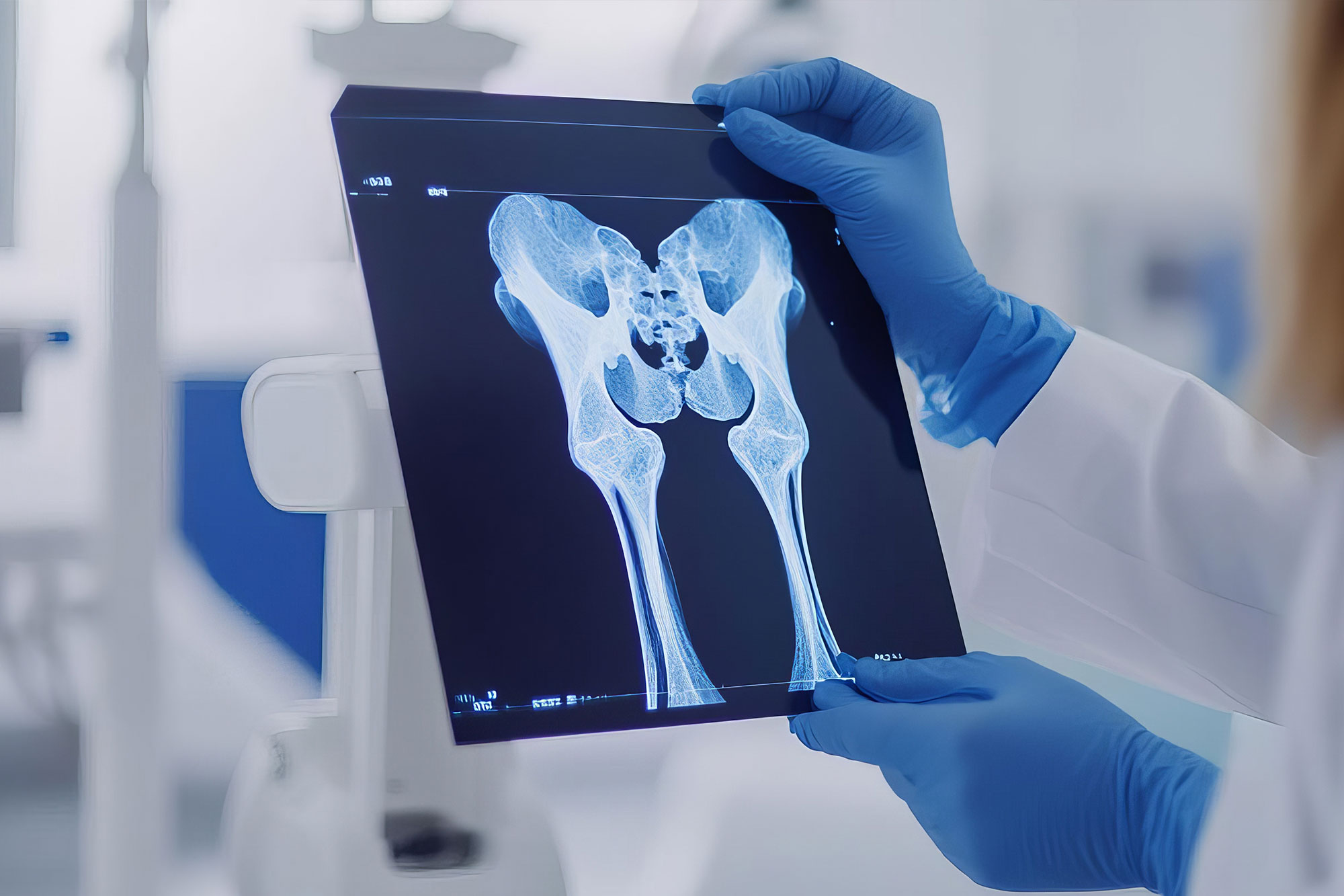 42103_Braisch_Knochendichte